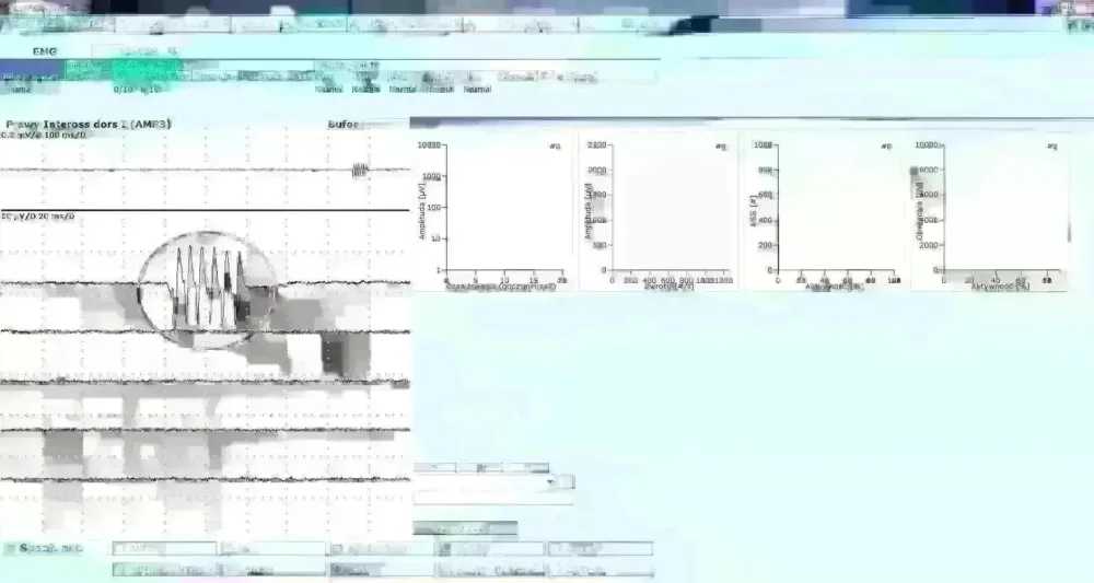 EMG
