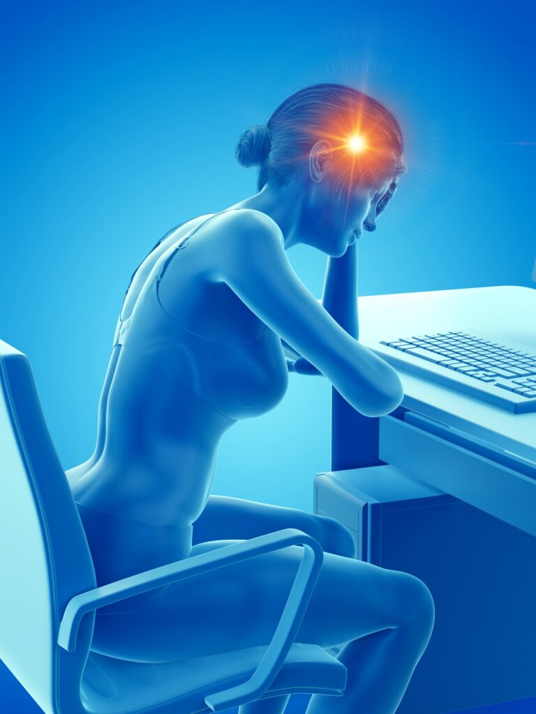 Migrena — ilustracja medyczna przedstawiająca mechanizm bólu głowy